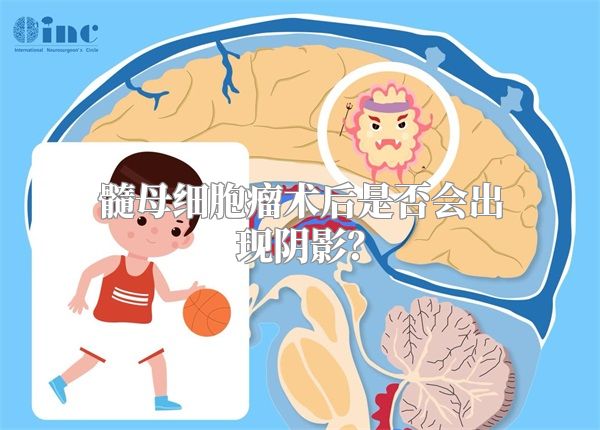 髓母细胞瘤术后是否会出现阴影？