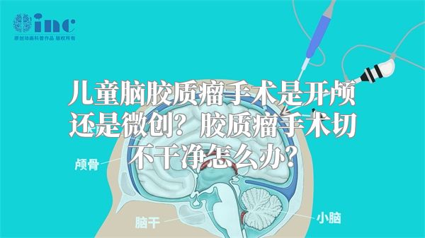 儿童脑胶质瘤手术是开颅还是微创？胶质瘤手术切不干净怎么办？