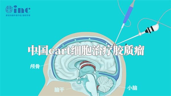 中国cart细胞治疗胶质瘤