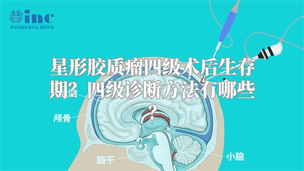 星形胶质瘤四级术后生存期？四级诊断方法有哪些？