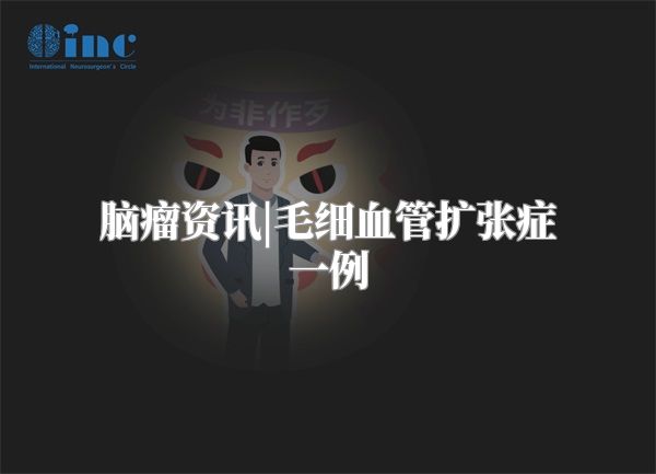 脑瘤资讯|毛细血管扩张症一例