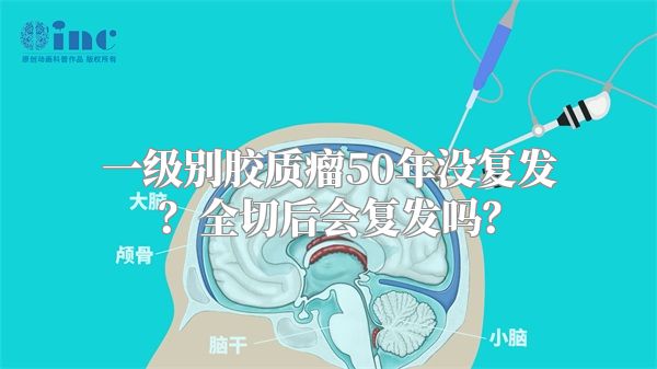 一级别胶质瘤50年没复发？全切后会复发吗？