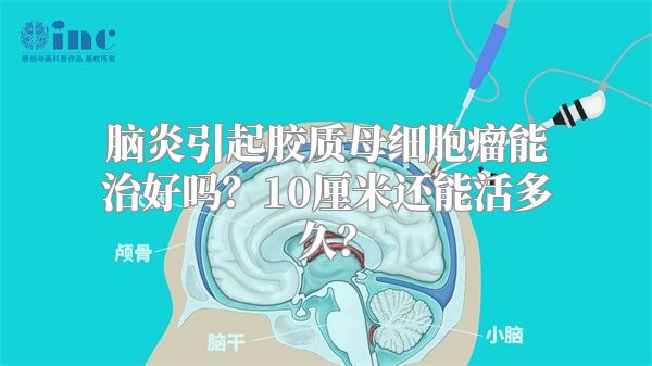 脑炎引起胶质母细胞瘤能治好吗？10厘米还能活多久？