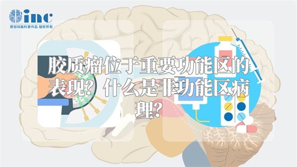 胶质瘤位于重要功能区的表现？什么是非功能区病理？