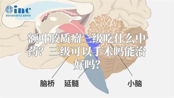 额叶胶质瘤三级吃什么中药？三级可以手术吗能治好吗？