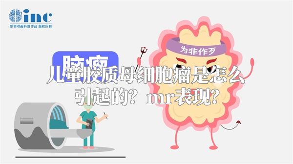 儿童胶质母细胞瘤是怎么引起的？mr表现？