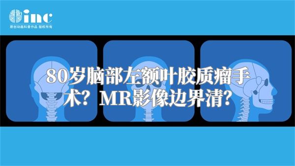 80岁脑部左额叶胶质瘤手术？MR影像边界清？