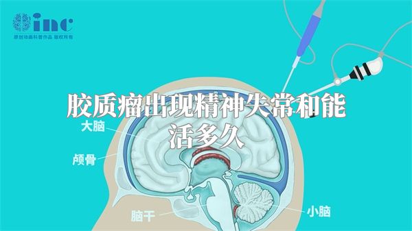 胶质瘤出现精神失常和能活多久