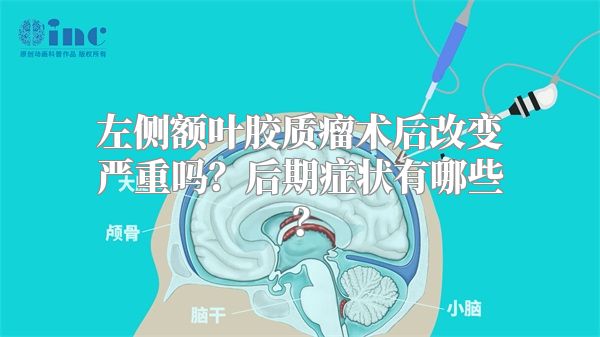 左侧额叶胶质瘤术后改变严重吗？后期症状有哪些？