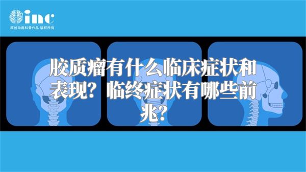 胶质瘤有什么临床症状和表现？临终症状有哪些前兆？
