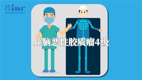 丘脑恶性胶质瘤4级
