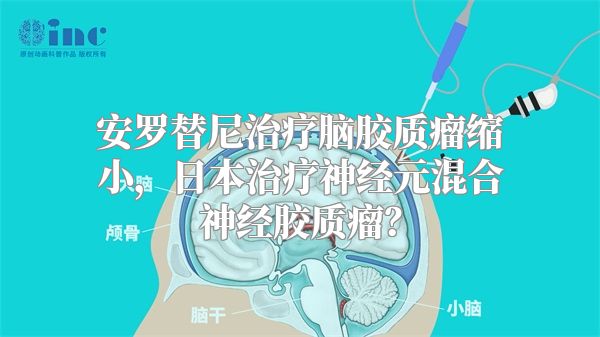 安罗替尼治疗脑胶质瘤缩小，日本治疗神经元混合神经胶质瘤？