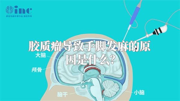 胶质瘤导致手脚发麻的原因是什么？