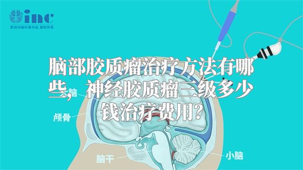 脑部胶质瘤治疗方法有哪些，神经胶质瘤三级多少钱治疗费用？
