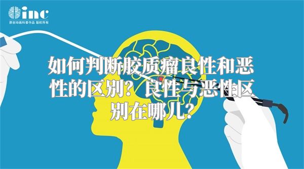 如何判断胶质瘤良性和恶性的区别？良性与恶性区别在哪儿？