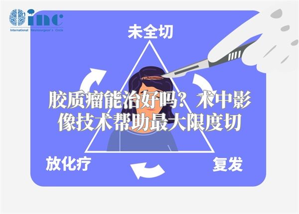 胶质瘤能治好吗？术中影像技术帮助最大限度切
