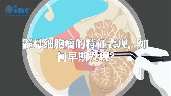 髓母细胞瘤的特征表现，如何早期发现？