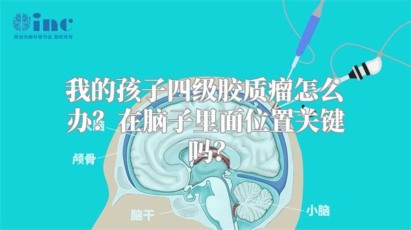 我的孩子四级胶质瘤怎么办？在脑子里面位置关键吗？