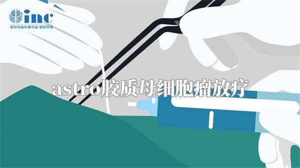 astro胶质母细胞瘤放疗