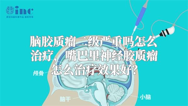 脑胶质瘤二级严重吗怎么治疗，嘴巴里神经胶质瘤怎么治疗效果好？