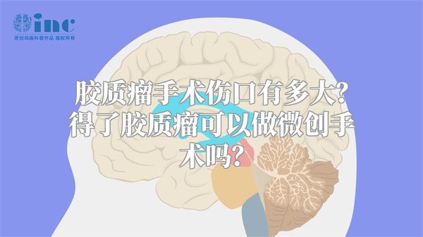 胶质瘤手术伤口有多大？得了胶质瘤可以做微创手术吗？