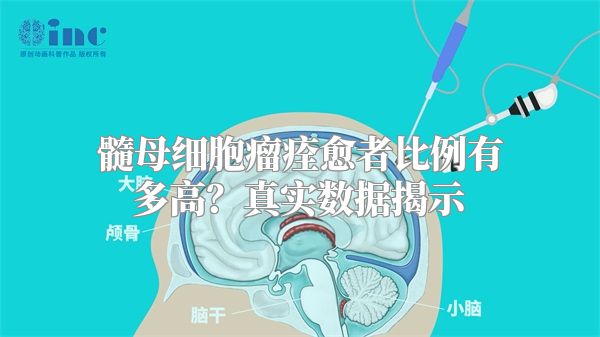髓母细胞瘤痊愈者比例有多高？真实数据揭示