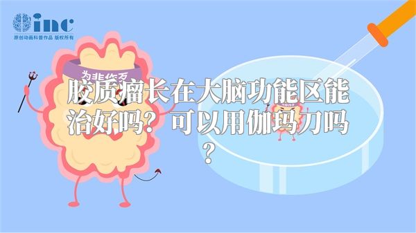 胶质瘤长在大脑功能区能治好吗？可以用伽玛刀吗？
