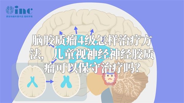 脑胶质瘤4级怎样治疗方法，儿童视神经神经胶质瘤可以保守治疗吗？