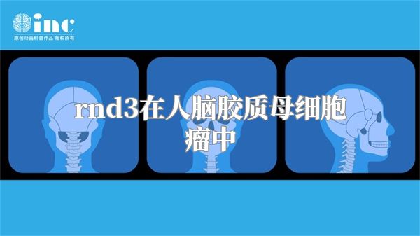 rnd3在人脑胶质母细胞瘤中