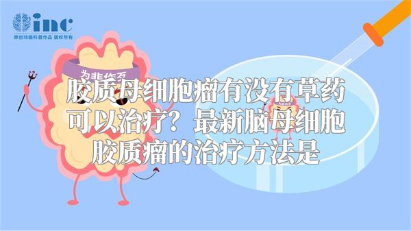 胶质母细胞瘤有没有草药可以治疗？最新脑母细胞胶质瘤的治疗方法是