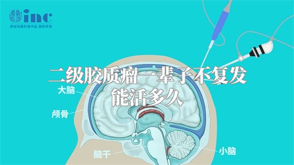 二级胶质瘤一辈子不复发能活多久