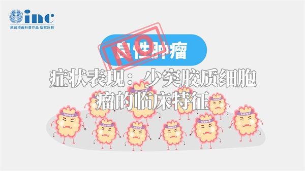 症状表现：少突胶质细胞瘤的临床特征
