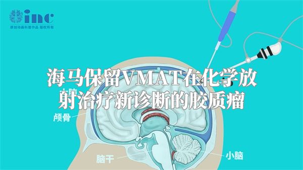 海马保留VMAT在化学放射治疗新诊断的胶质瘤