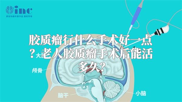 胶质瘤行什么手术好一点？老人胶质瘤手术后能活多久？