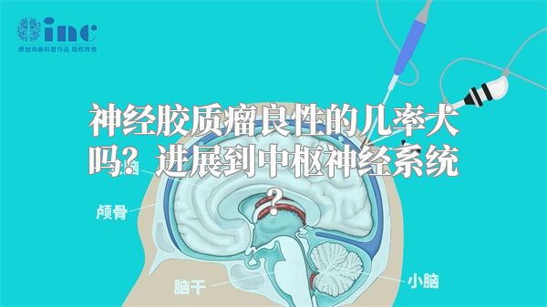 神经胶质瘤良性的几率大吗？进展到中枢神经系统？