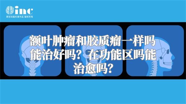 额叶肿瘤和胶质瘤一样吗能治好吗？在功能区吗能治愈吗？