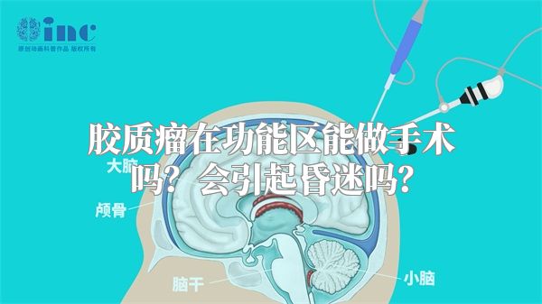 胶质瘤在功能区能做手术吗？会引起昏迷吗？