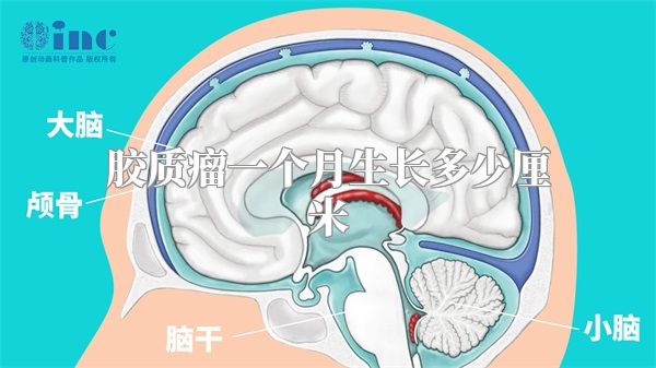 胶质瘤一个月生长多少厘米