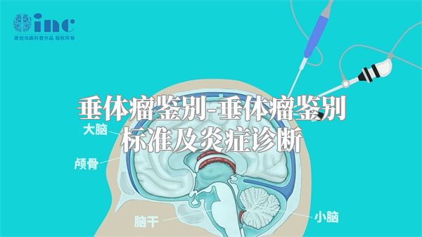 垂体瘤鉴别-垂体瘤鉴别标准及炎症诊断