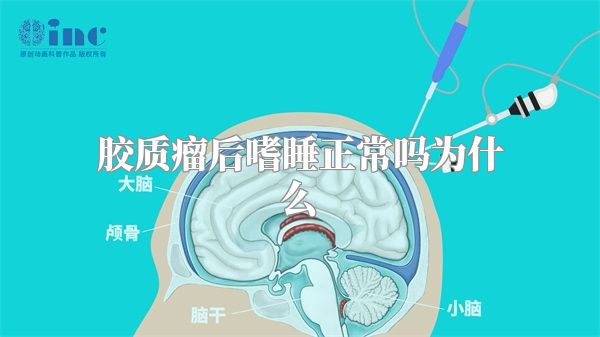 胶质瘤后嗜睡正常吗为什么