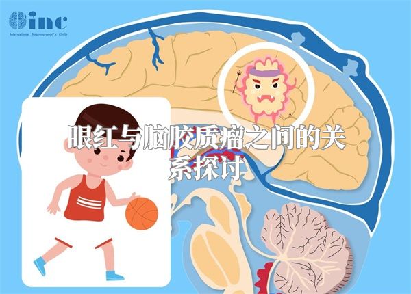 眼红与脑胶质瘤之间的关系探讨
