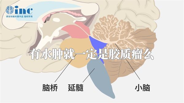 有水肿就一定是胶质瘤么