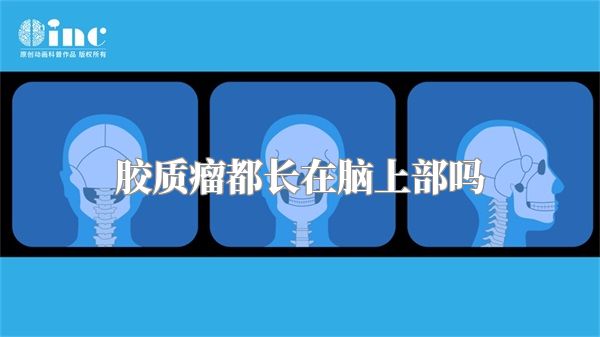 胶质瘤都长在脑上部吗