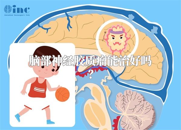 脑部神经胶质瘤能治好吗？