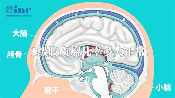 1级胶质瘤几率多大正常