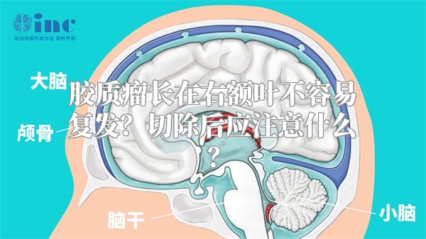 胶质瘤长在右额叶不容易复发？切除后应注意什么？