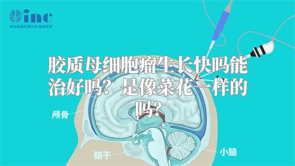 胶质母细胞瘤生长快吗能治好吗？是像菜花一样的吗？