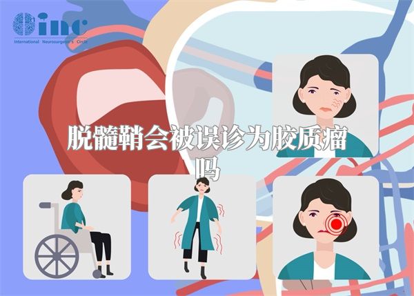 脱髓鞘会被误诊为胶质瘤吗