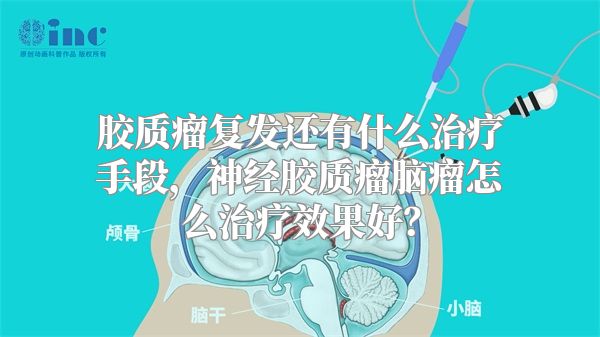 胶质瘤复发还有什么治疗手段，神经胶质瘤脑瘤怎么治疗效果好？