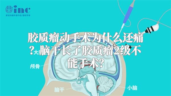 胶质瘤动手术为什么还痛？脑干长了胶质瘤2级不能手术？